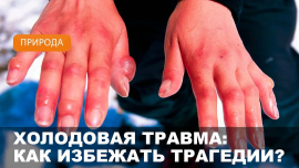 Чем опасна холодовая травма?