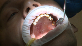 Современные технологии в протезировании зубов